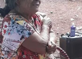 81-year-old Brazilian woman dies after surgery to remove 56-year-old deceased foetus